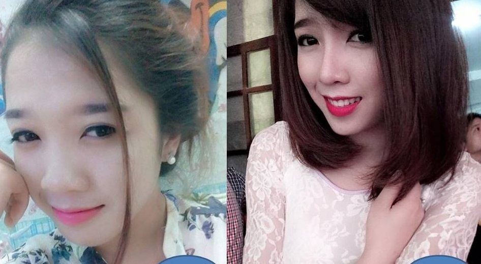 Có nên nâng mũi s line? Lời khuyên từ chuyên gia 4