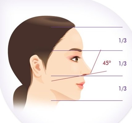 Sửa mũi hếch, mũi ngắn