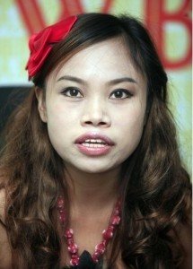 Vì sao chiếc mũi tẹt “kém giá” và cải thiện bằng cách nào?
