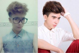 Tư vấn: Nâng mũi Hàn Quốc sụn mềm là gì?